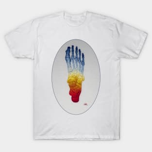 Raynaud's Disease T-Shirt